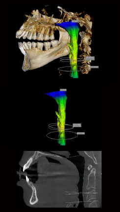 Bild von Röntgen-Scans des Carestream CS 8200 3D Advance